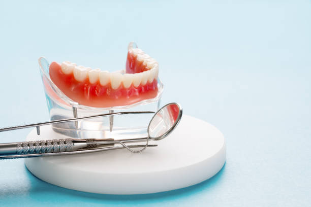 Full Mouth Reconstruction in Elizabethton, TN